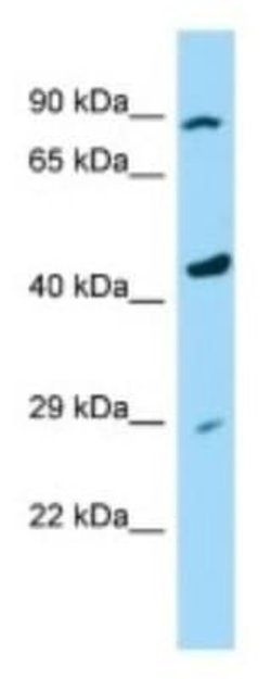 PAMCI Rabbit anti-Human, Polyclonal, Novus Biologicals:Antibodies:Primary